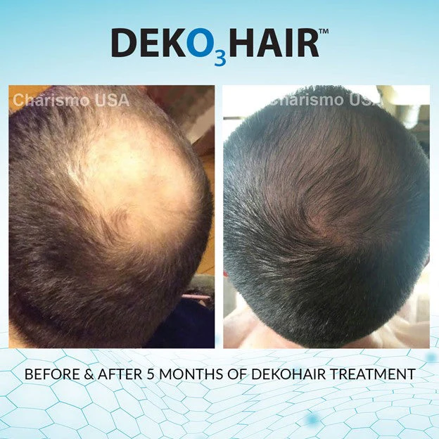 DEKOHAIR 3-Month Bundle - Image 4